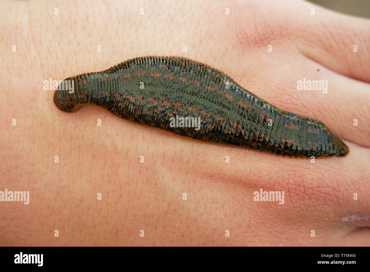 Sangsue médicinale Hirudo medicinalis Sangsue - - morsure, Leech est de sucer du sang sur le corps humain (main). Banque D'Images