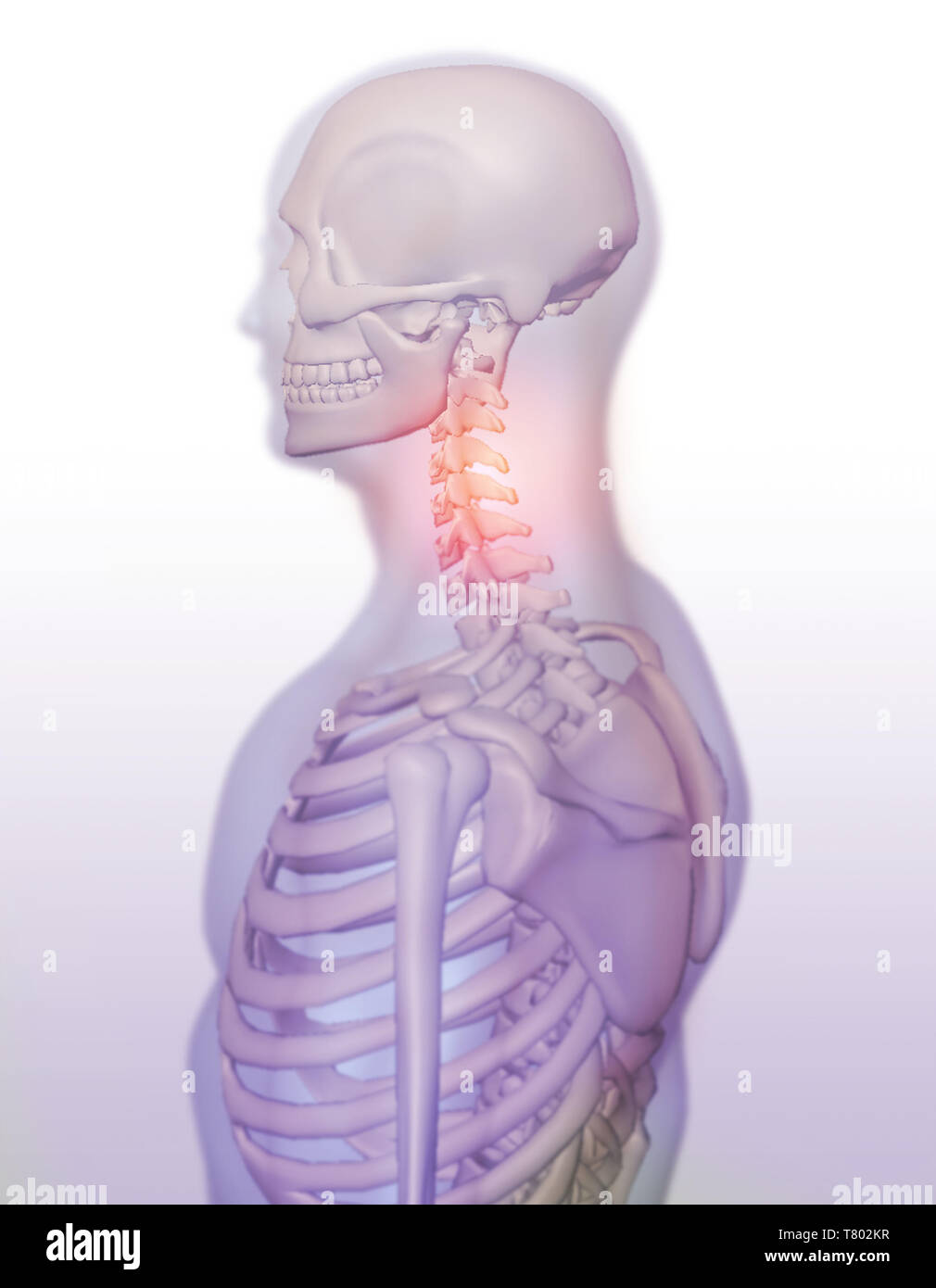 La douleur au cou, illustration Banque D'Images