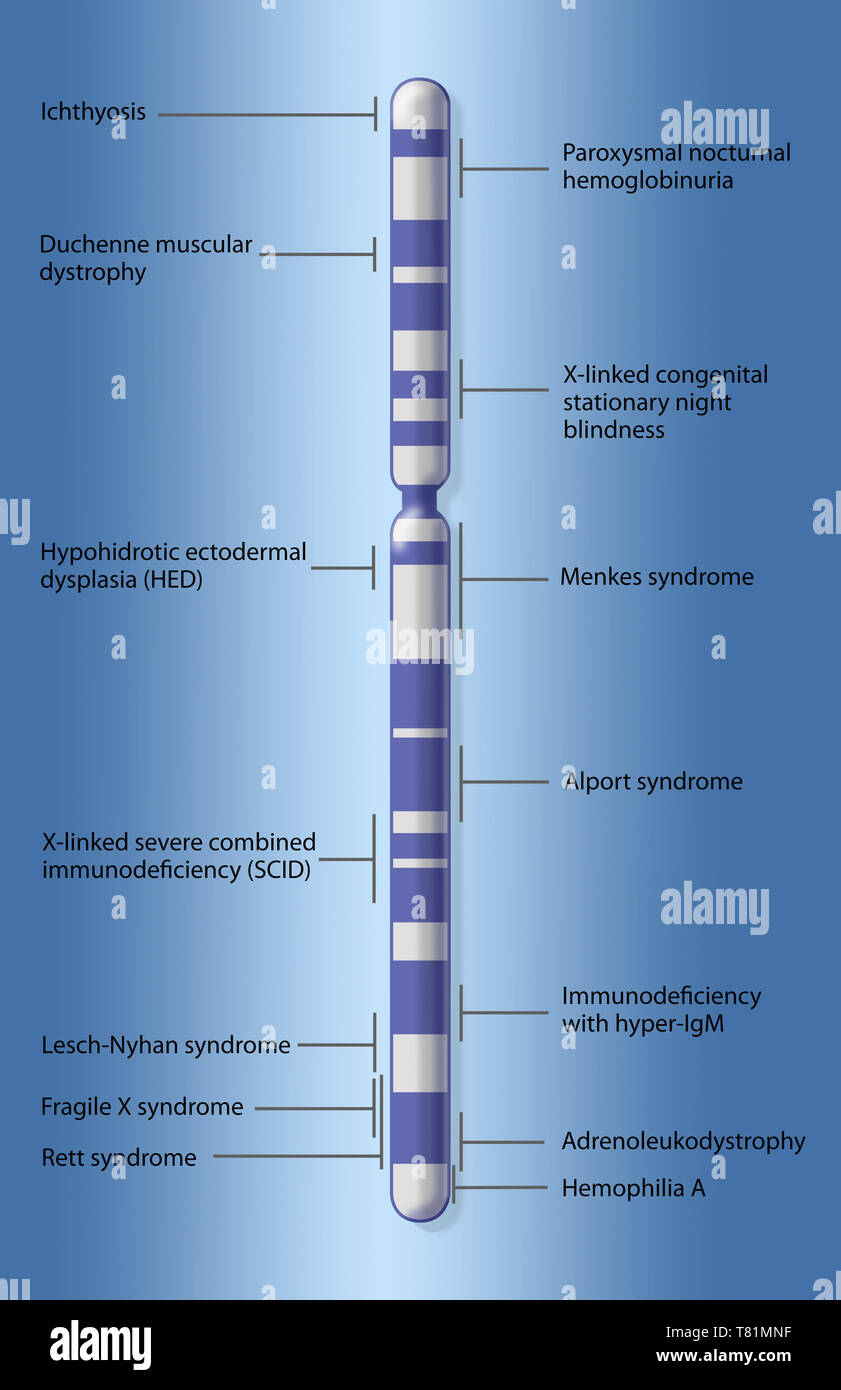 X carte chromosomique de la maladie, de l'illustration Banque D'Images