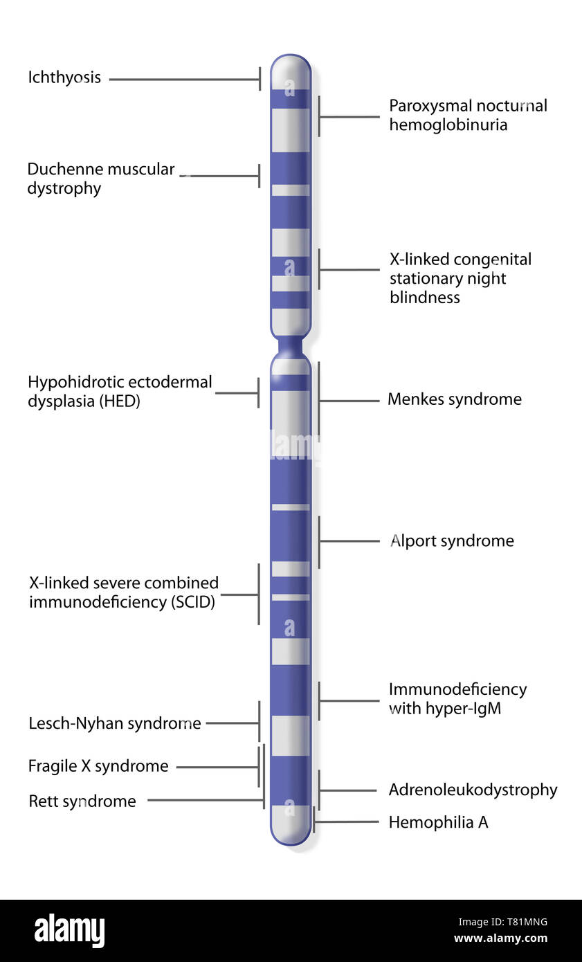 X carte chromosomique de la maladie, de l'illustration Photo Stock Alamy