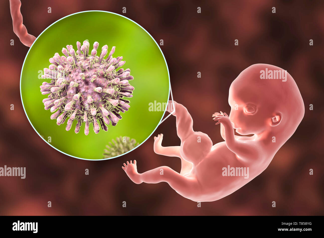 Le VIH infecte les droits de l'embryon, illustration Banque D'Images