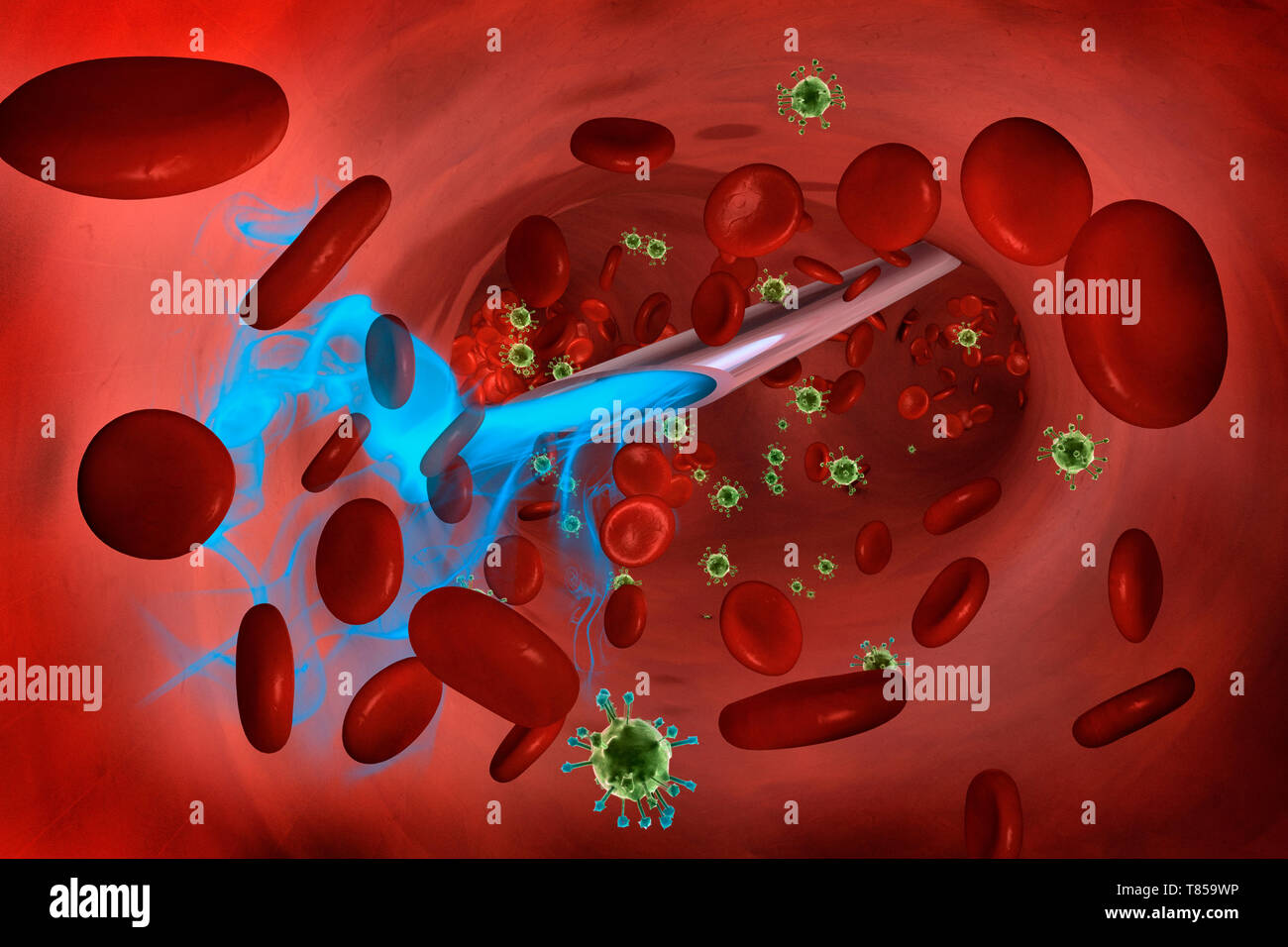 Injection dans la circulation sanguine, illustration Banque D'Images