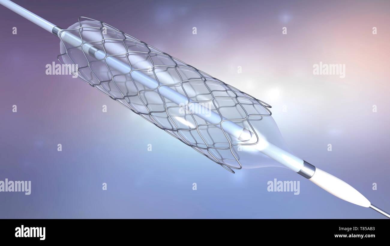 Stent ballonnet, illustration Banque D'Images