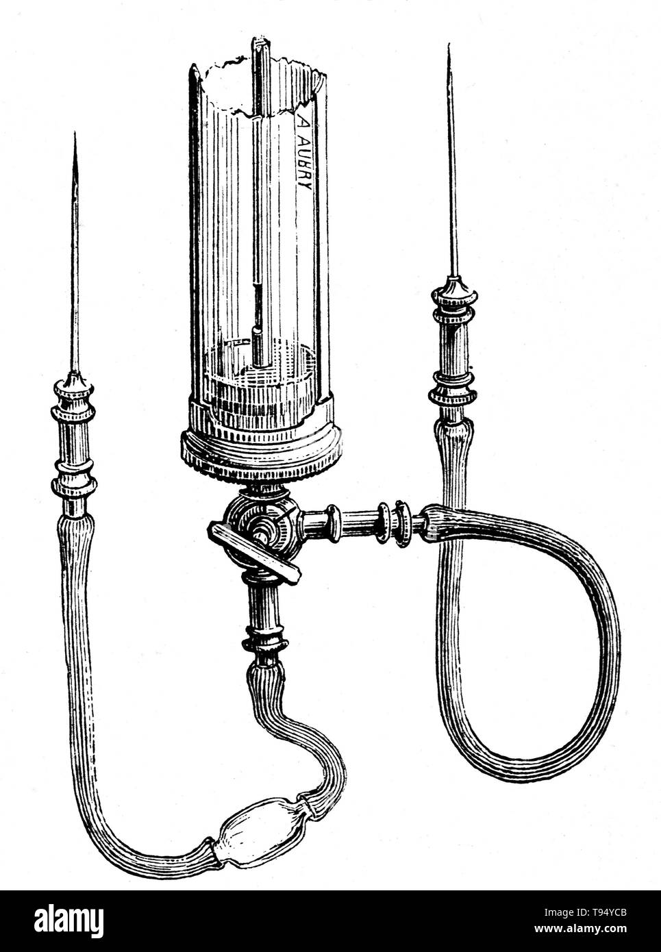 Appareils de transfusion sanguine par LeBlonds et Collins, à partir de 1876. Début avec Harvey's expériences avec la circulation du sang, la recherche sur la transfusion de sang a commencé au 17ème siècle, avec des expériences réussies dans la transfusion entre animaux. Cependant, les tentatives successives de la part des médecins à transfuser le sang d'animal dans l'homme a donné variable, souvent mortelles, les résultats. Début des transfusions sanguines entre les humains ont été risqué et beaucoup ont entraîné la mort du patient. Ce n'est qu'en 1901, lorsque l'autrichien Karl Landsteiner découvre les groupes sanguins, les transfusions de sang qui est devenu plus sûr. Banque D'Images