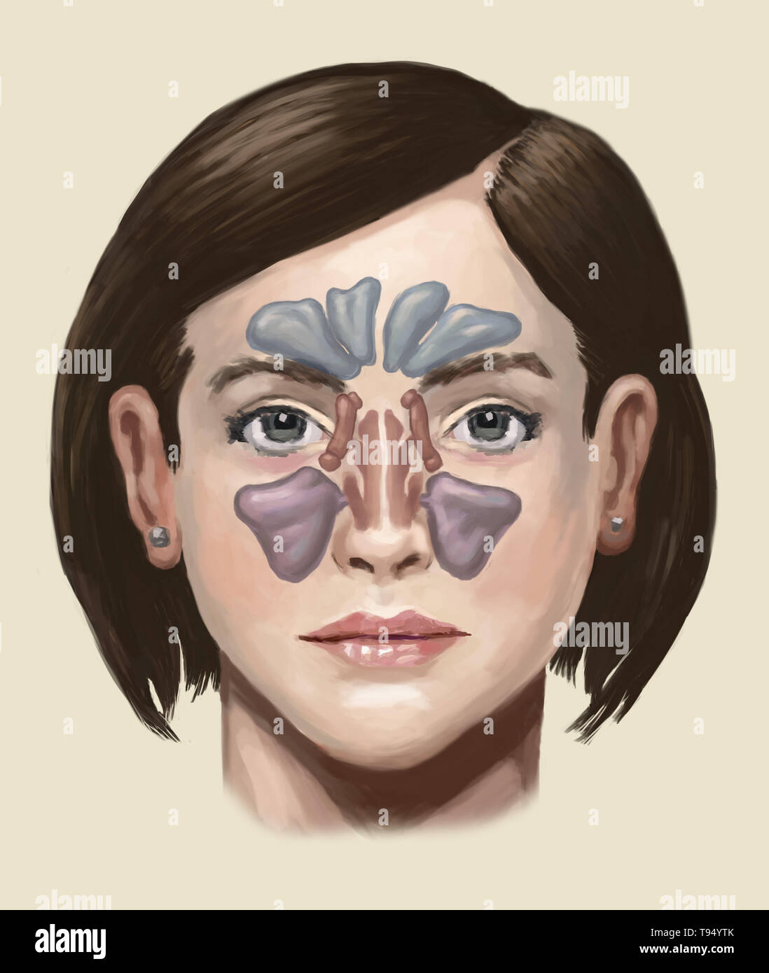 Illustration des sinus. De haut en bas, ils comprennent : le sinus frontal, sinus sphénoïdal l, le sinus ethmoïde, et le sinus maxillaire. Banque D'Images