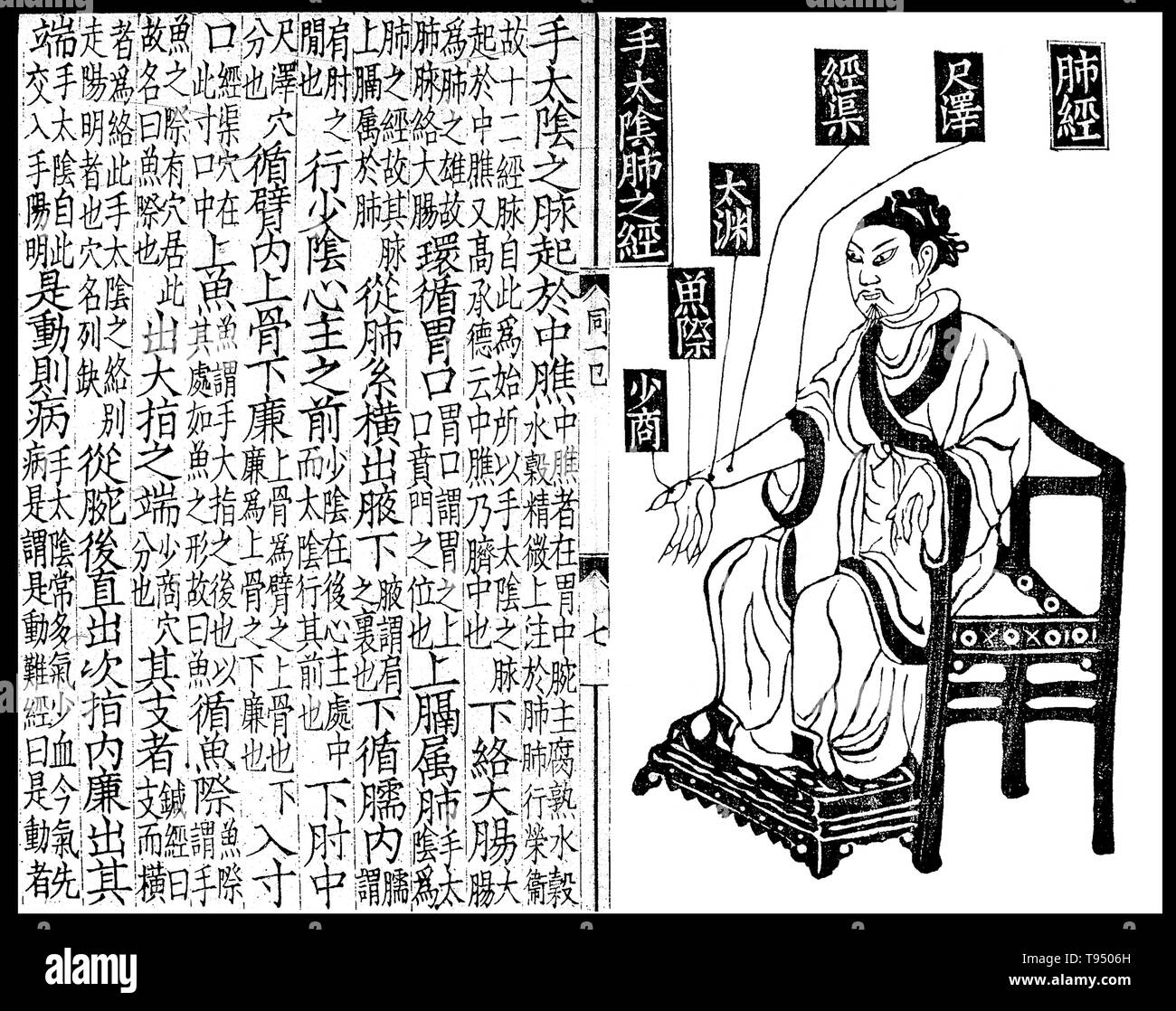Illustration sur bois d'une édition de 1909 (1ère année du règne Xuantong période de la dynastie Qing) montrant les points sur la voie pulmonaire de arm taiyin. À partir de la 11e siècle classic tongren shuxue zhenjiu Bu zhu tujing (livre de l'Acupuncture et la moxibustion de l'homme canon de bronze avec Notes et commentaires) par Wang Weiyi. Les points marqués sont Deshaies (pied), marais jingqu (Canal Fosse), taiyuan (grand abîme), Yuji (frontière) et de poissons (shaoshang Shang moindre). Banque D'Images