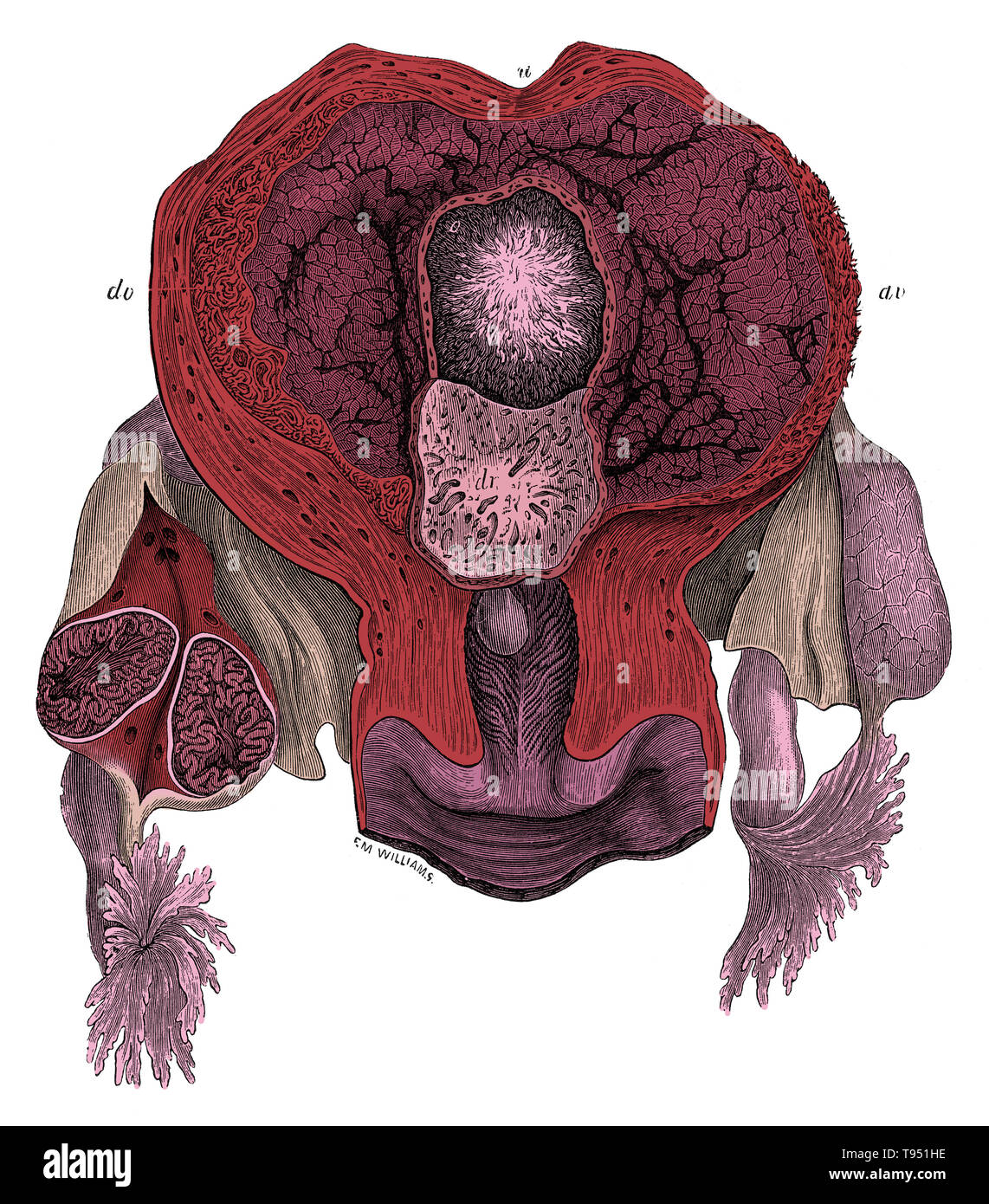 Vue de l'intérieur de l'utérus gravide au 25e jour. u, paroi utérine ; o, de l'ovule avec chorion villeux ; dv, decidua vera ; dr, decidua reflexa, réparties autour de la marge de l'ovule, et se tourna vers le bas de façon à exposer son piqué dont la surface a été retiré de l'ovule. L'ovaire droit est divisé, et montre dans l'article l'état du début dupliquée corps jaune. Jones Quain (novembre 1796 - janvier 31, 1865) était un anatomiste, professeur d'anatomie et de physiologie de l'Université de Londres, et l'auteur d'éléments de l'anatomie. Cette image a été colorisées. Banque D'Images