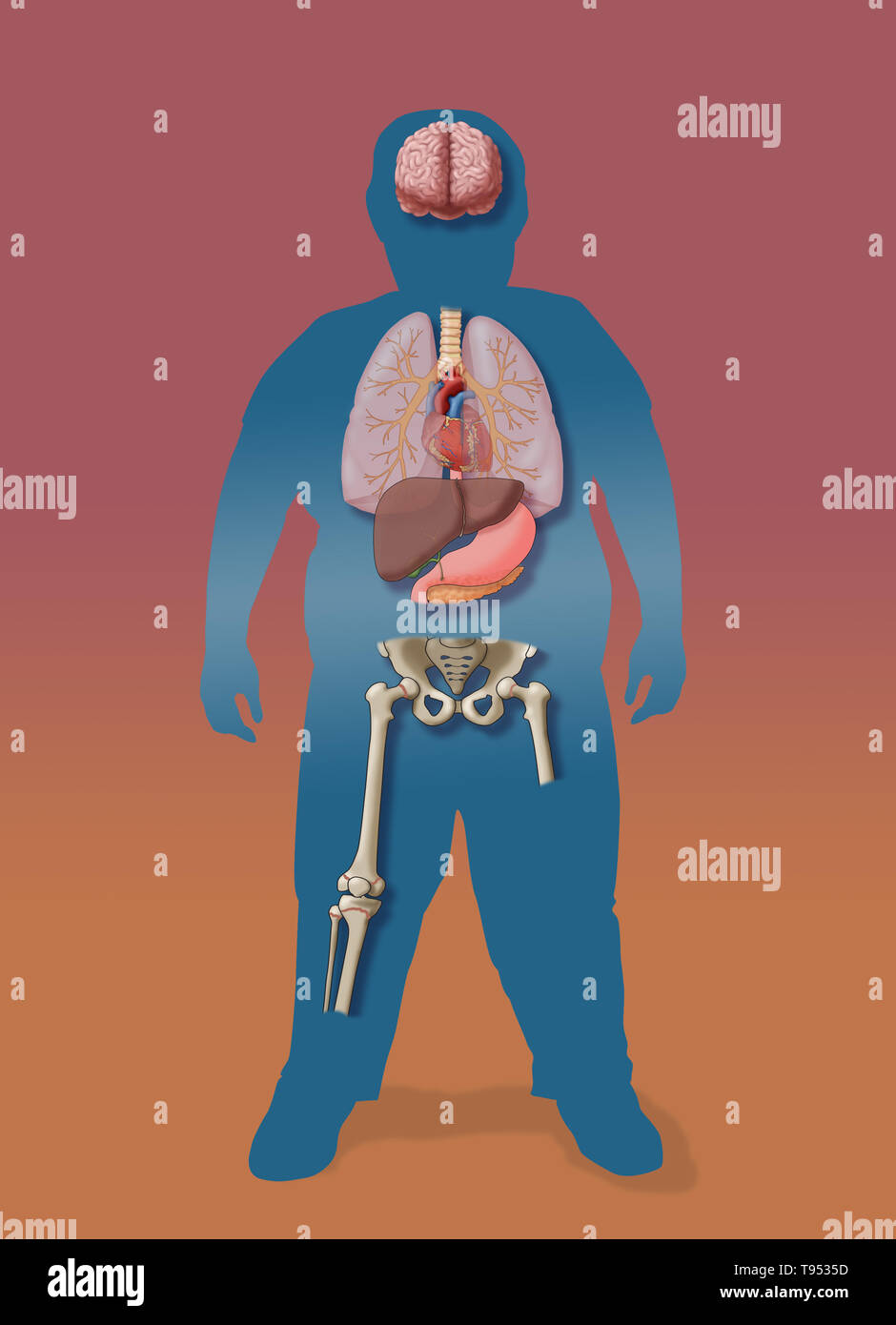 Une illustration de les conséquences médicales de l'obésité chez les enfants. Banque D'Images