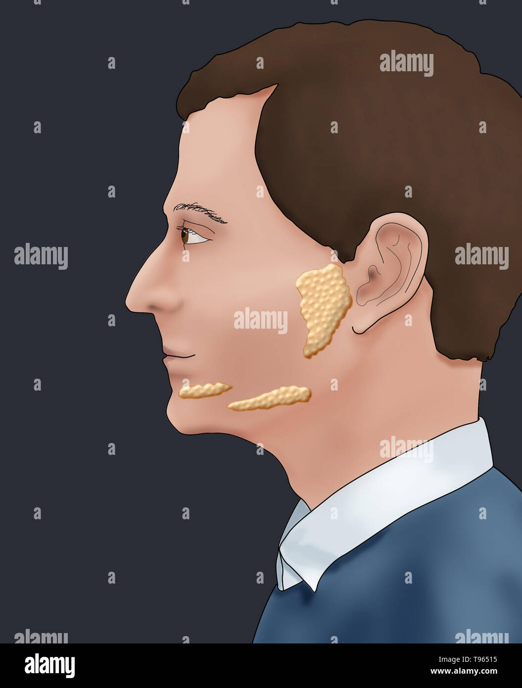 Illustration montrant l'emplacement des glandes salivaires dans un profil masculin. Banque D'Images