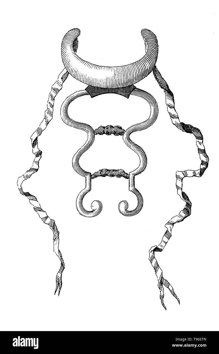 Pirou's chin-pièce pour redresser le cou. À l'origine, le terme Orthopédie signifiait la correction de malformations musculo-squelettiques chez les enfants. Nicolas Andry de Bois-Regard (1658 - 13 mai 1742) un professeur français à l'Université de Paris a inventé le terme dans le premier manuel écrit sur le sujet, orthopédie, en 1741. Il a plaidé pour l'utilisation de l'exercice, la manipulation et d'attelles pour traiter les malformations chez les enfants. Illustration par James Hullet, 1743. Banque D'Images