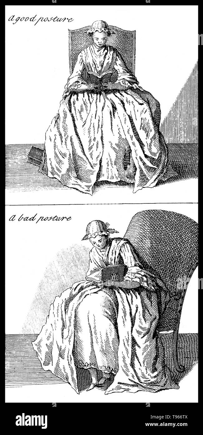 Femme assise lisant montrant une bonne posture et une mauvaise posture. À l'origine, le terme Orthopédie signifiait la correction de malformations musculo-squelettiques chez les enfants. Nicolas Andry de Bois-Regard (1658 - 13 mai 1742) un professeur français à l'Université de Paris a inventé le terme dans le premier manuel écrit sur le sujet, orthopédie, en 1741. Il a plaidé pour l'utilisation de l'exercice, la manipulation et d'attelles pour traiter les malformations chez les enfants. Illustration par James Hullet, 1743. Banque D'Images