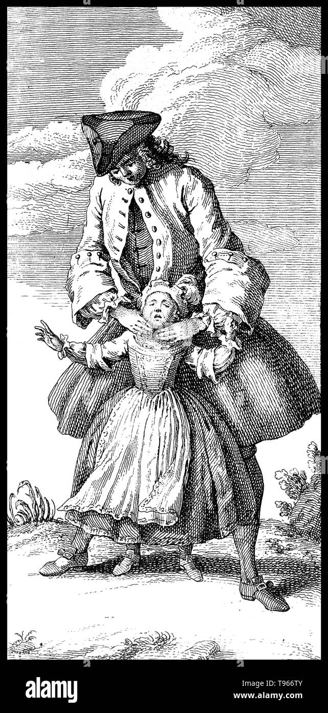 Homme Femme Enfant de levage par le cou. À l'origine, le terme Orthopédie signifiait la correction de malformations musculo-squelettiques chez les enfants. Nicolas Andry de Bois-Regard (1658 - 13 mai 1742) un professeur français à l'Université de Paris a inventé le terme dans le premier manuel écrit sur le sujet, orthopédie, en 1741. Le livre principal de l'influence durable dans la médecine a été son titre, qui est devenu le nom de la rubrique consacrée aux restes et des blessures et maladies. Banque D'Images