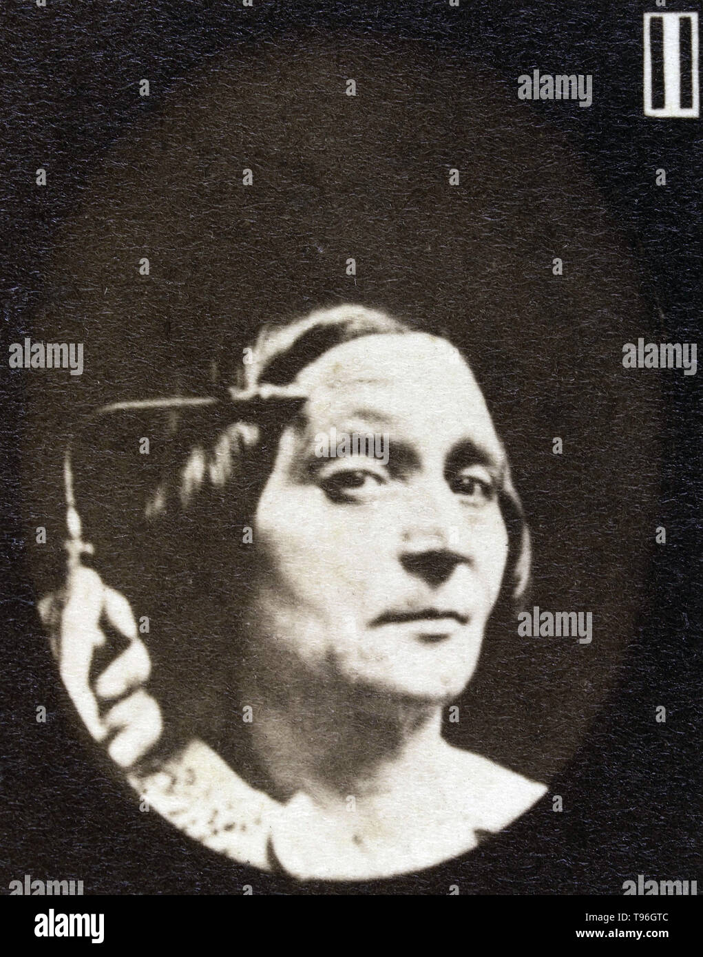 L'expression du visage de l'attention sur le visage humain d'être induits par les courants électriques. Guillaume-Benjamin Duchenne de Boulogne-Amand (17 septembre 1806 - 15 septembre 1875) est un neurologue français qui a permis à la science de l'électrophysiologie. Influencé par les croyances de physionomie, la dystrophie voulait déterminer comment les muscles dans le visage humain produisent des expressions du visage qu'il croyait être directement liée à l'âme de l'homme. Banque D'Images