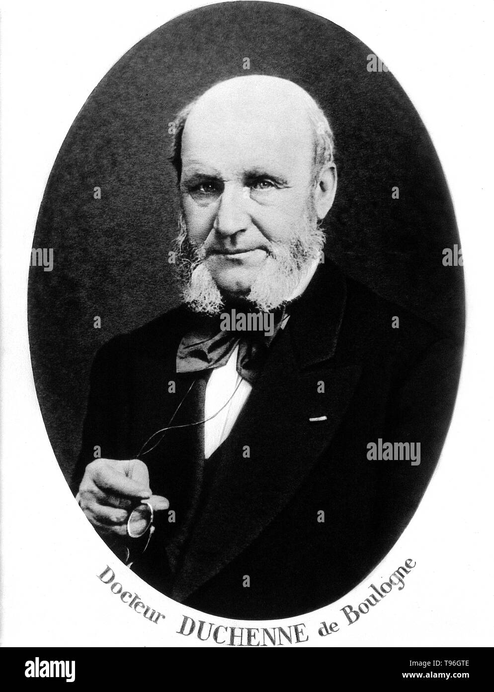 Guillaume-Benjamin Duchenne de Boulogne-Amand (17 septembre 1806 - 15 septembre 1875) est un neurologue français qui a permis à la science de l'électrophysiologie. Influencé par les croyances de physionomie, la dystrophie voulait déterminer comment les muscles dans le visage humain produisent des expressions du visage qu'il croyait être directement liée à l'âme de l'homme. Banque D'Images