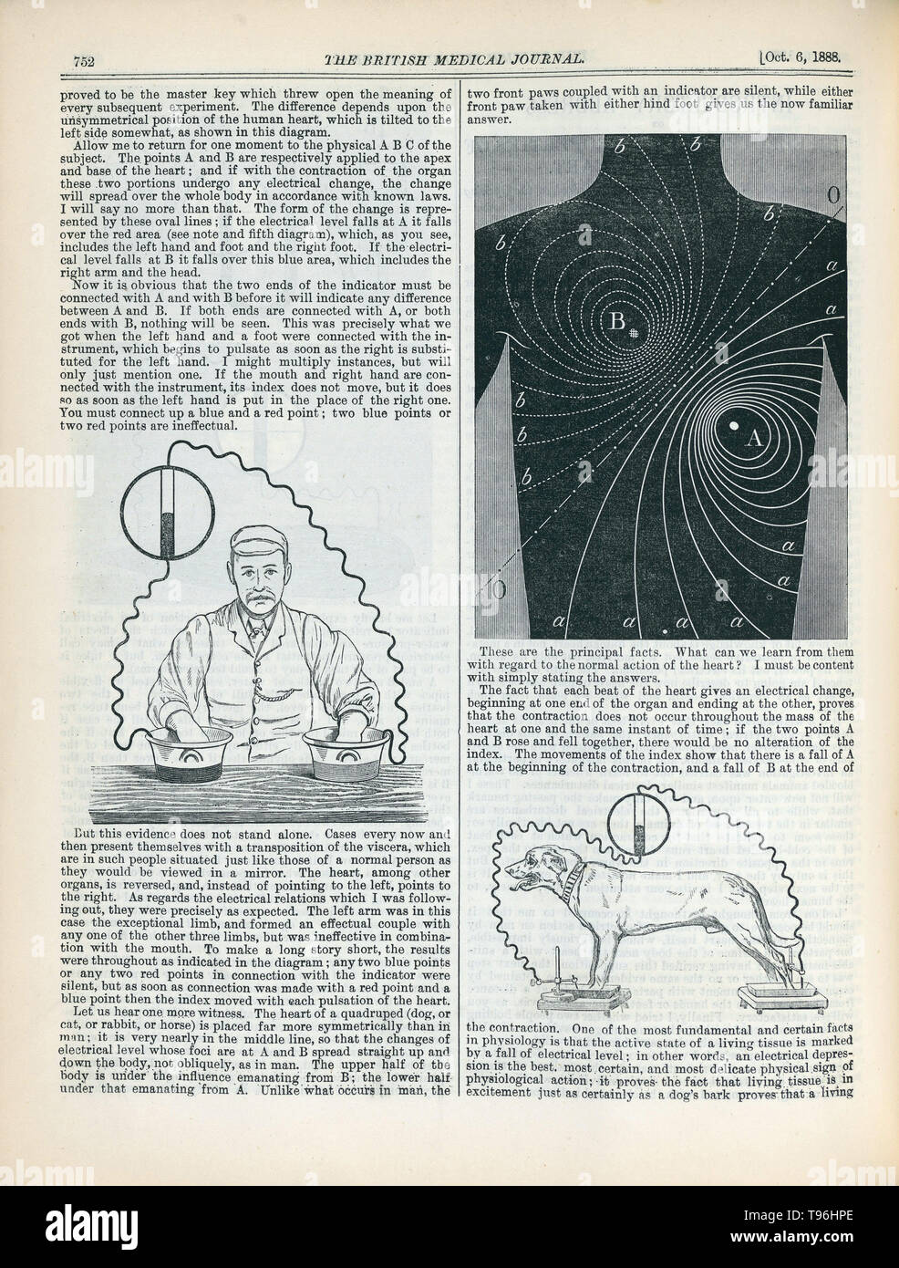 ''L'adresse d'introduction sur la force électromotrice propriétés du coeur humain'', par Augustus Waller, British Medical Journal, Vol 2. Octobre 1888. Augustus Desiré Waller (Juillet 18, 1856 - Mars 11, 1922) était un physiologiste britannique. Il a étudié la médecine à l'Université d'Aberdeen, où il s'est qualifié en 1878 et obtenu son doctorat en 1881. En 1884 il devint professeur de physiologie à l'Hôpital St Mary. En 1887 il s'est servi d'un électromètre capillaire pour enregistrer le premier des droits de l'électrocardiogramme. Banque D'Images