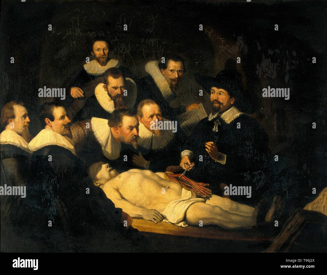 Intitulé : "La leçon d'Anatomie du Dr Nicolaes Tulp' reproduction de peinture de Rembrandt van Rijn. Dissection humaine est couramment pratiqué dans l'enseignement de l'anatomie pour les étudiants de médecine. Pas de l'interdiction universelle de dissection ou d'autopsie n'a été exercé au Moyen Âge. Certains pays européens ont commencé à légaliser la dissection de criminels exécutés à des fins éducatives dans la fin du 13e et début 14e siècles. La leçon d'Anatomie du Dr Banque D'Images