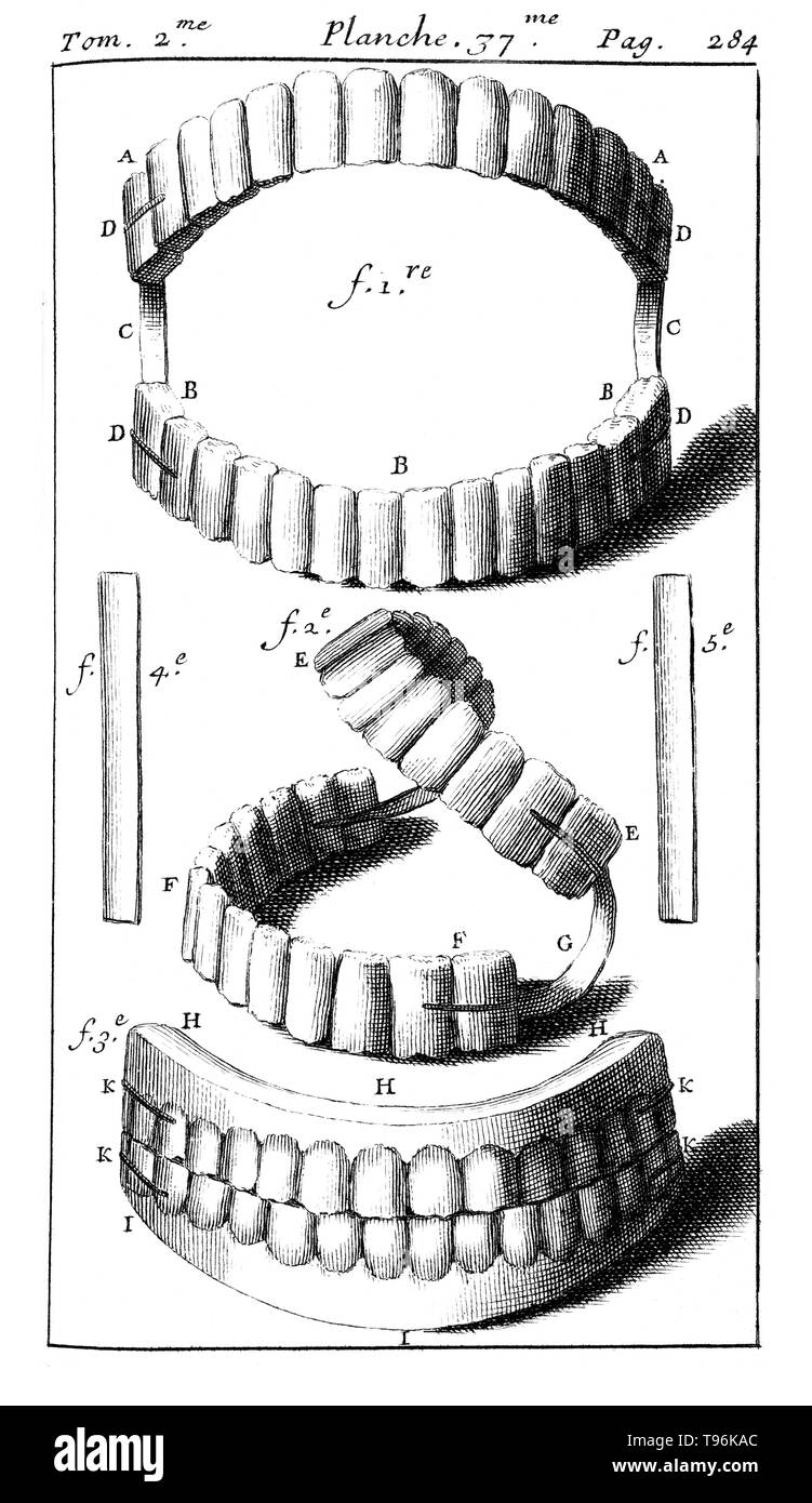 Ensemble complet de dentiers avec ressorts. Tome 2. Planche 37. P. 284. Pierre Fauchard (1678 - 22 mars 1761) était un médecin français, considéré comme étant le père de la dentisterie moderne. Il est largement connu pour être la première description scientifique de la médecine dentaire, Le Chirurgien dentiste (chirurgien dentiste), le publié en 1728. Banque D'Images