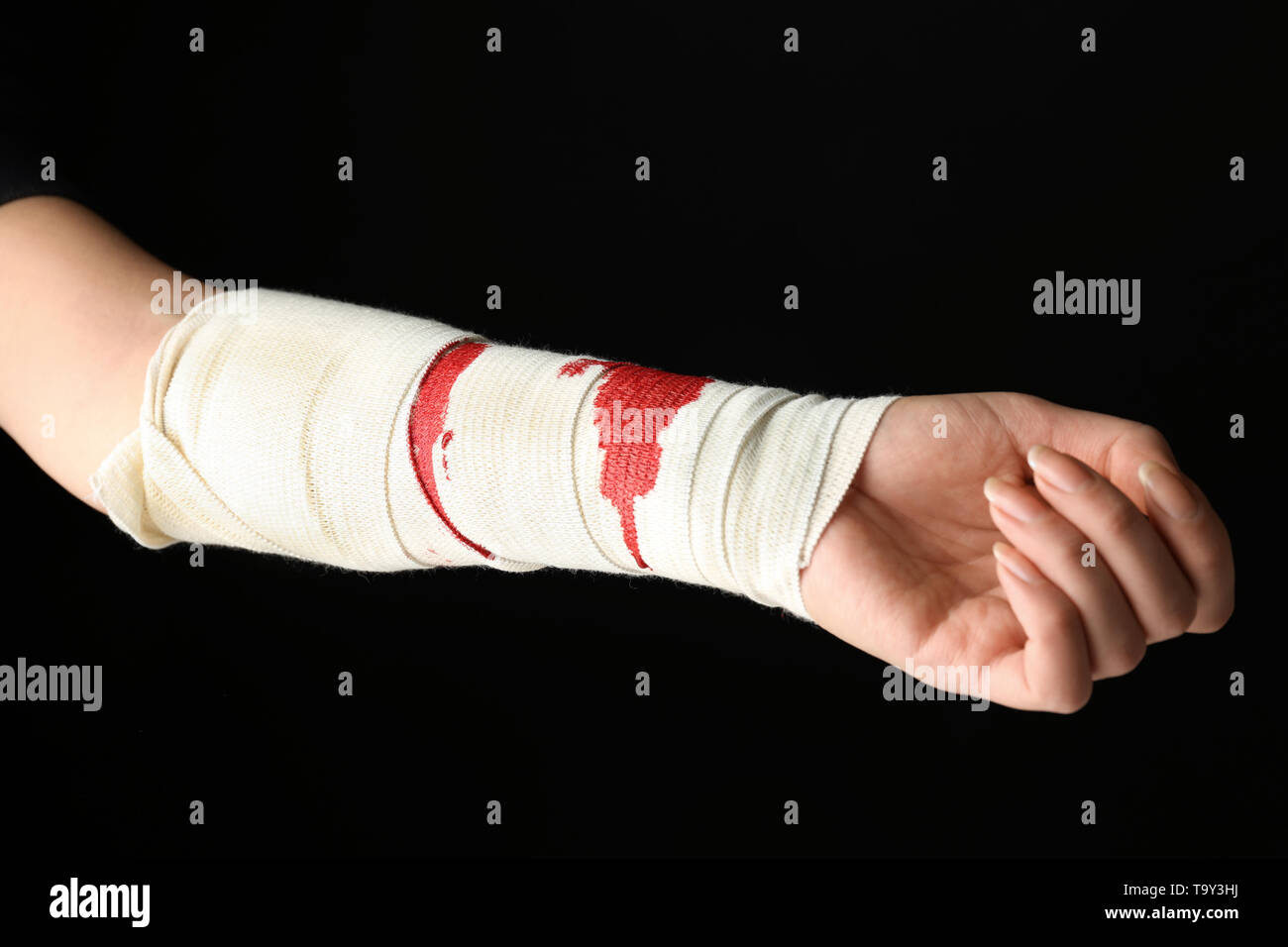 Arm bandage Banque de photographies et d'images à haute résolution - Alamy