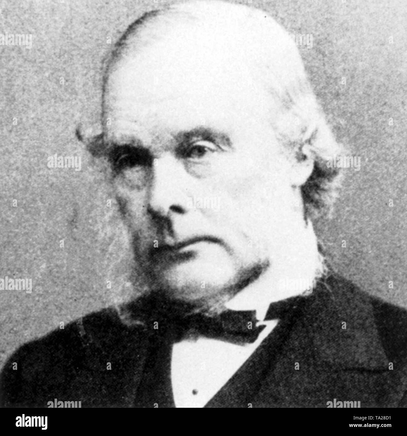 Baron Joseph Lister, un chirurgien britannique, professeur à Glasgow, Édimbourg et Londres (1877 - 1892). Sur la base des conclusions de Pasteur, Lister a essayé de lutter contre les infections de plaies ou de leurs agents, les microbes à l'aide de substances chimiques. Il a donc créé l'antisepsie. Banque D'Images