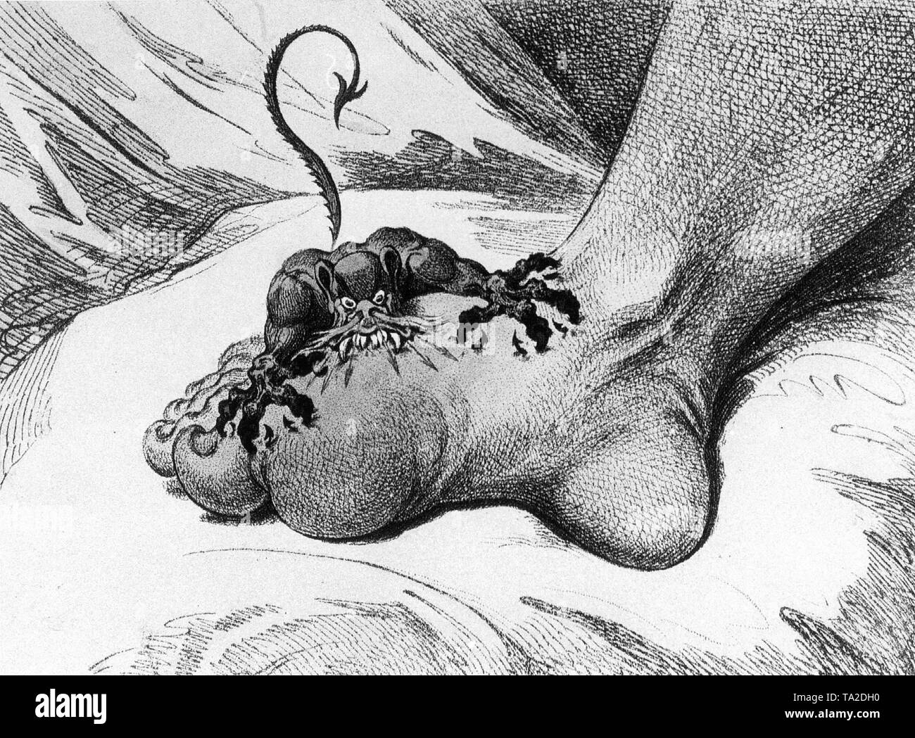 Illustration de la douleur. L'illustrateur et caricaturiste James Gillray (1757 - 1815), qui a lui-même souffert de la goutte, cette caricature publiée en 1799. Banque D'Images