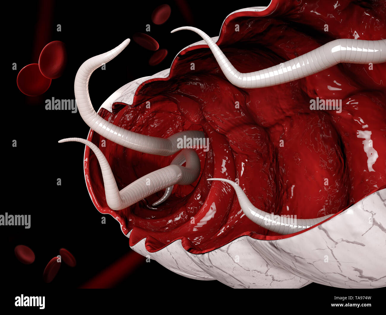 3d illustration d'un les oxyures dans le gros intestin. Banque D'Images