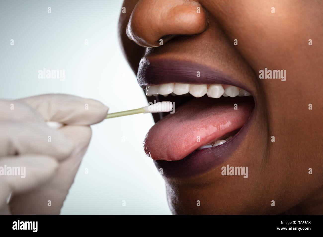 En tenant la main du dentiste de test de salive bouche de femme avec du coton-tige Banque D'Images