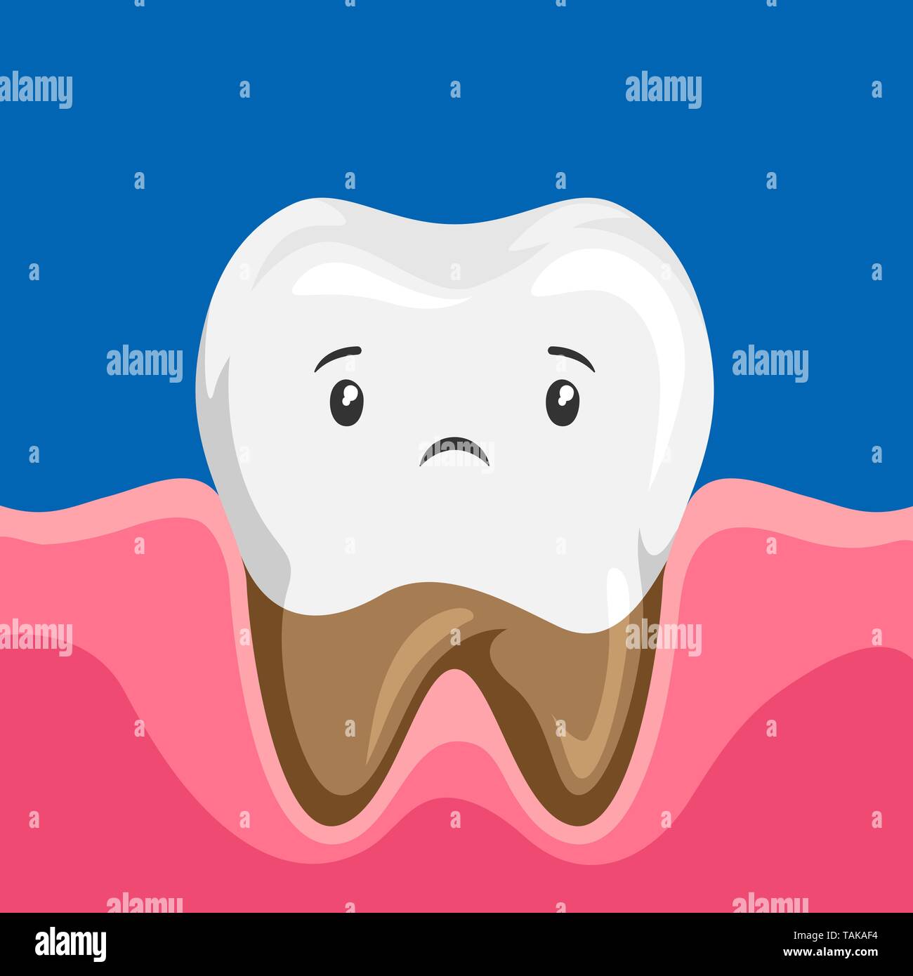 Illustration de la dent malade avec des racines pourries. Illustration de Vecteur