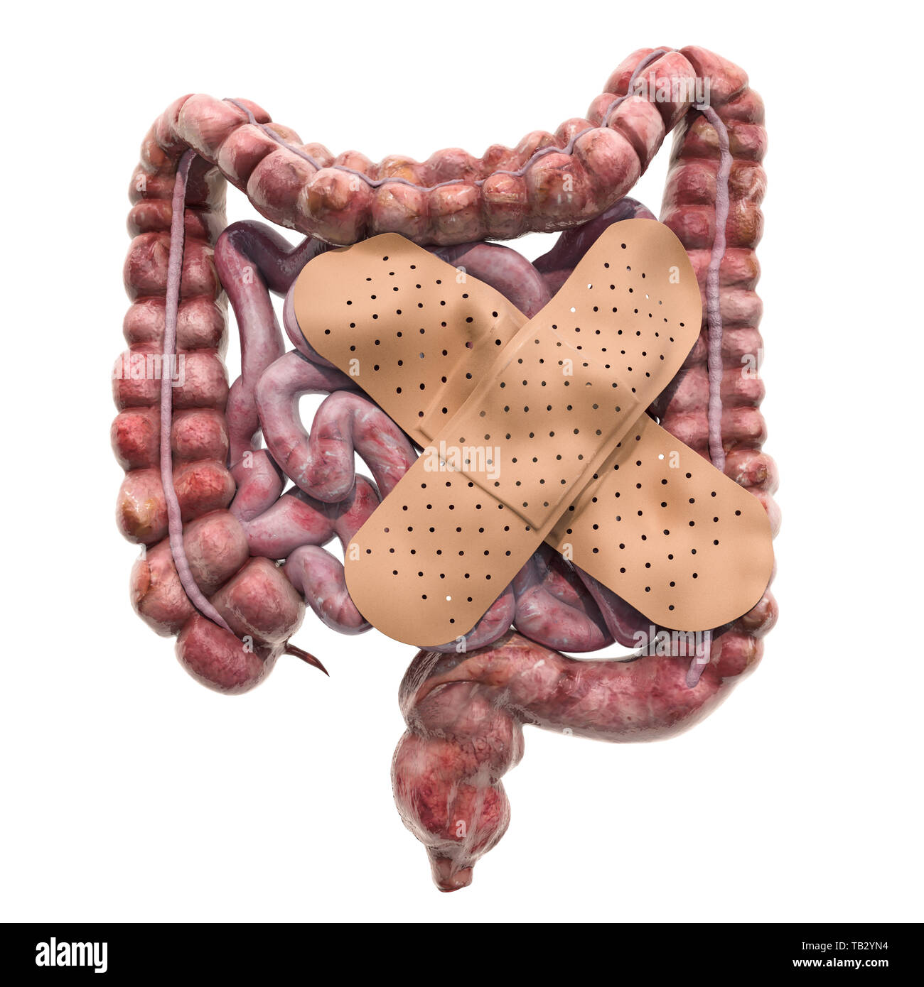 L'intestin humain avec des pansements adhésifs. Traitement de l'intestin, rendu 3D concept isolé sur fond blanc Banque D'Images