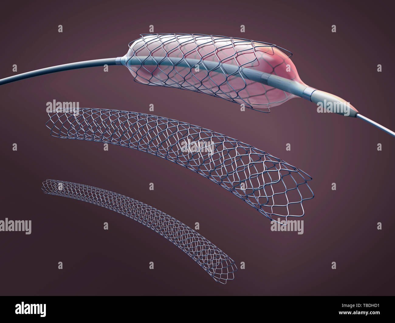Gonflé et dégonflé les stents et cathéters de ballon, de l'illustration. Banque D'Images