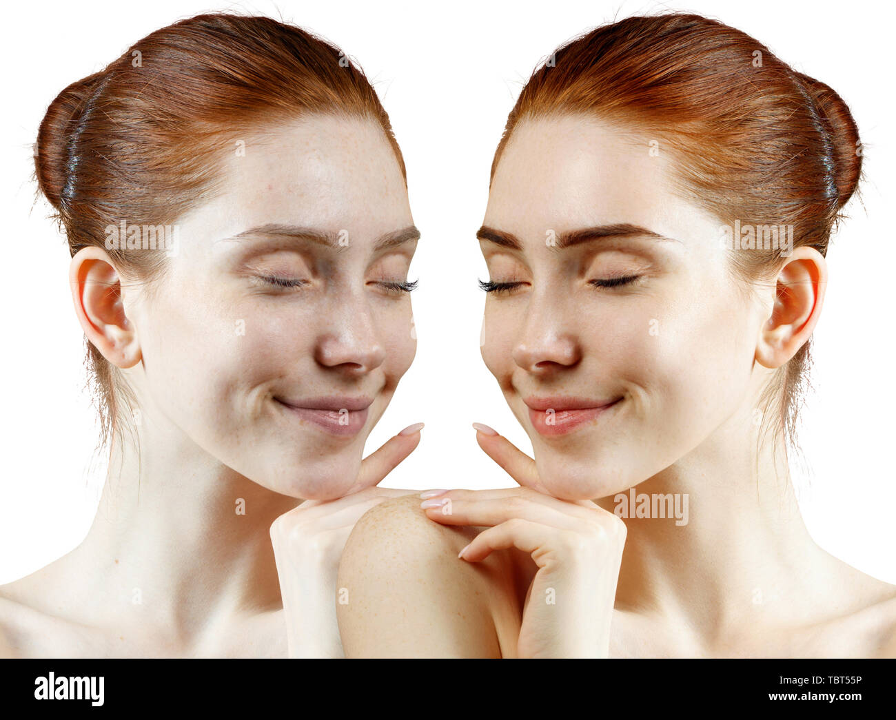 Femme rousse avant et après traitement de la peau et maquillage. Banque D'Images