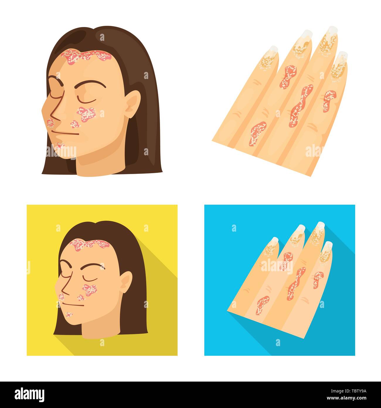 Le psoriasis,peau,body,eczéma,chroniques,allergie,stress,démangeaisons dermatite infection,,,fessier,de,fille,head,doigts,medical,la douleur,la maladie,dermatologie,healthcare,set,icône,,illustration,collection,isolé,design,graphisme,élément,signe, vecteurs vecteur , Illustration de Vecteur