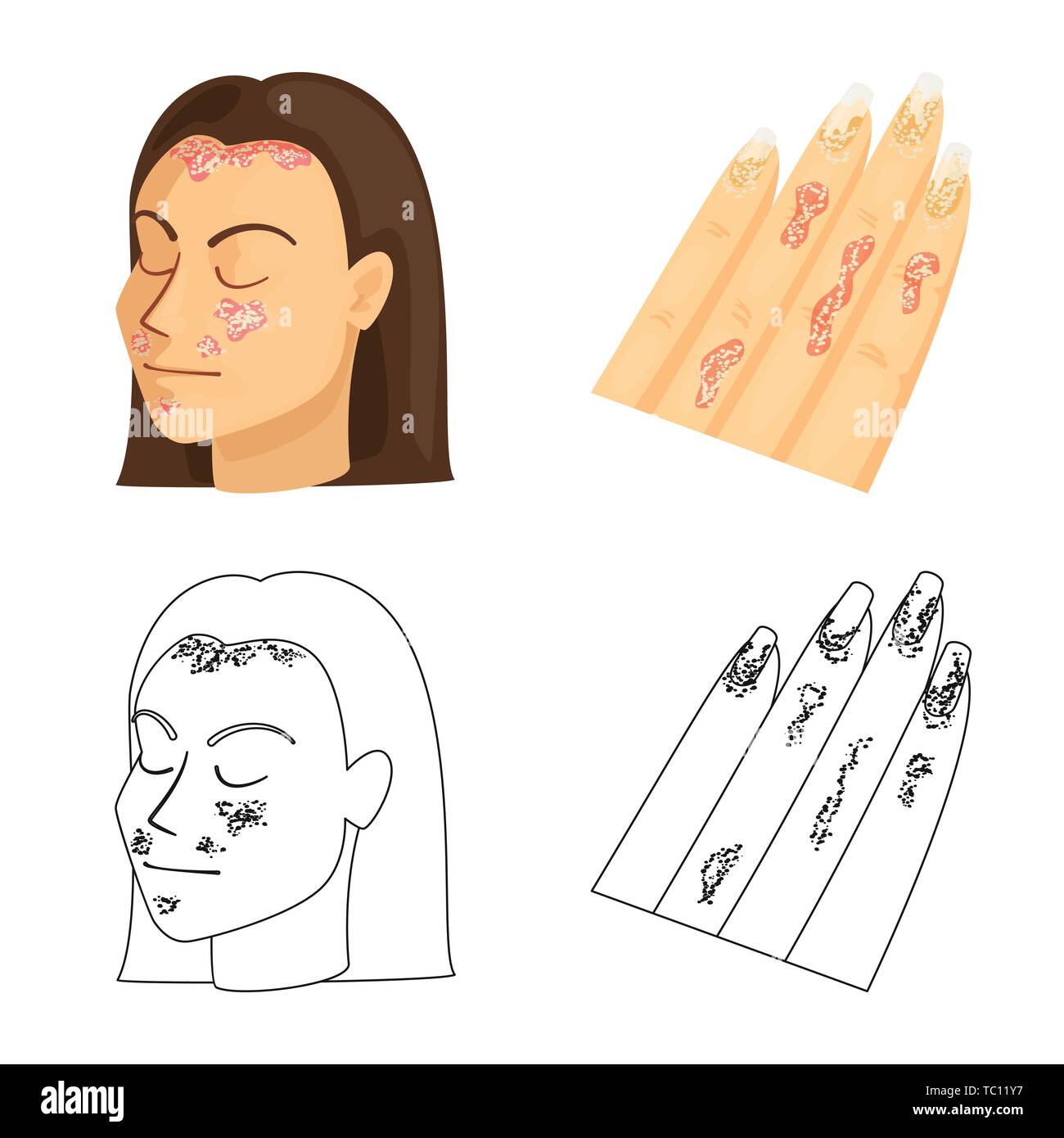 Le psoriasis,peau,body,eczéma,chroniques,allergie,stress,démangeaisons dermatite infection,,,fessier,de,fille,head,doigts,medical,la douleur,la maladie,dermatologie,healthcare,set,icône,,illustration,collection,isolé,design,graphisme,élément,signe, vecteurs vecteur , Illustration de Vecteur