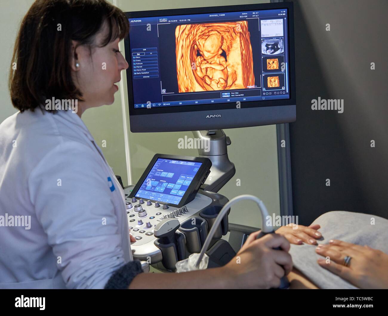 Des systèmes de diagnostic à ultrasons, l'échographie 4D, hôpital, Donostia, San Sebastian, Gipuzkoa, Pays Basque, Espagne Banque D'Images