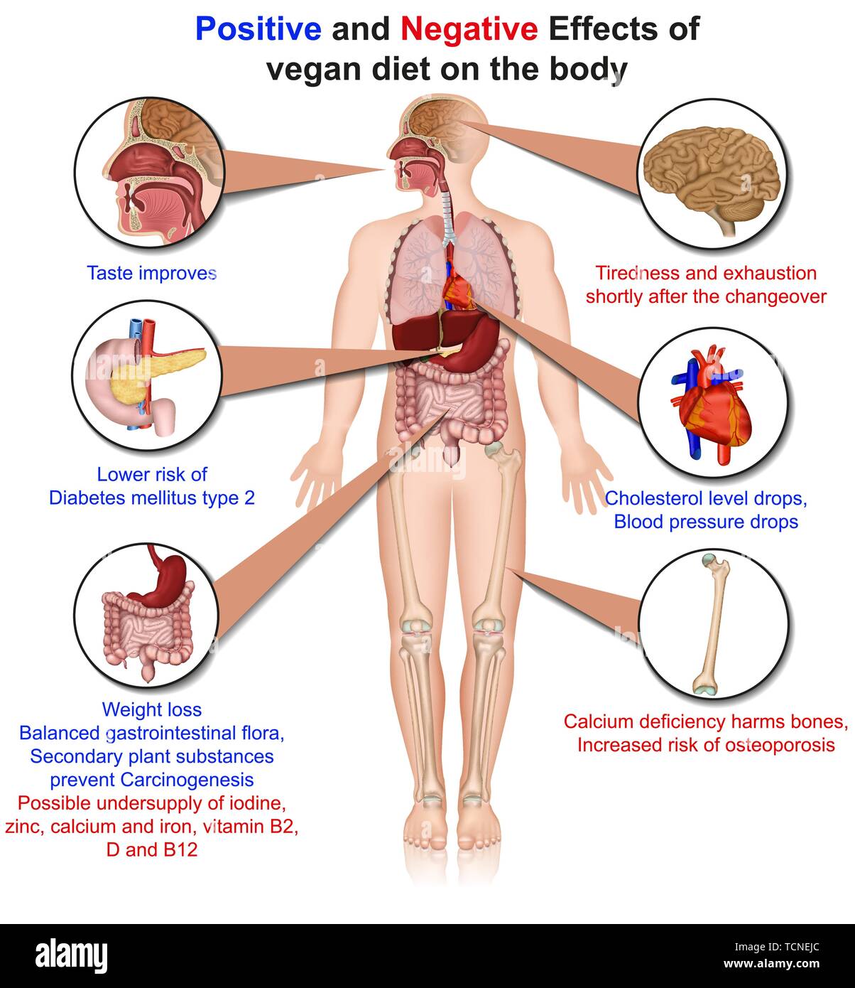 Effets positifs et négatifs de l'alimentation végétalienne, 3d medical vector illustration Illustration de Vecteur