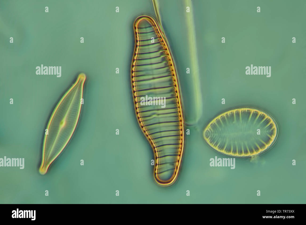 Diatomées (Diatomeae), les diatomées dans le contraste de phase et d'ingérence contre, x 160 Banque D'Images