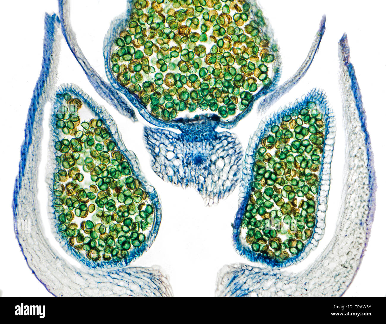 Section de la tête de mousse L.S. de cone montrant les spores, Salaginella caulescens, fond clair photomicrographie Banque D'Images