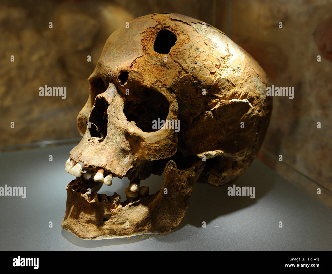 Crâne humain – Musées Occitanie