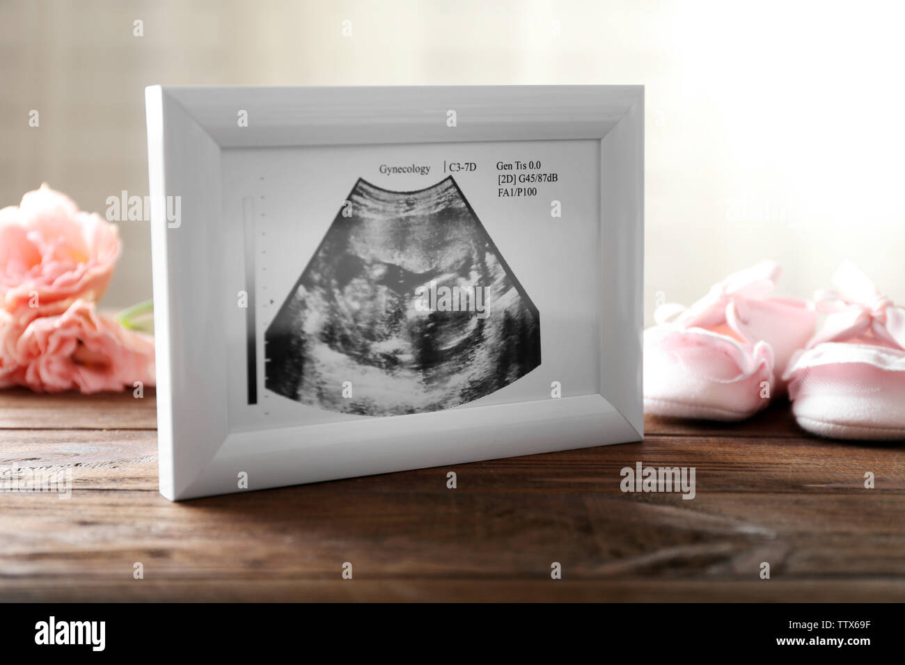 Échographie de bébé dans le cadre sur la table en bois Photo Stock - Alamy