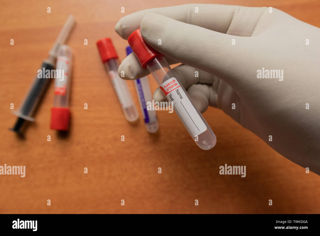 Pro-activateur de coagulation caillot de sang ordinaire du tube de prélèvement avec bouchon en plastique rouge,s'est tenue à la main en Inde, de laboratoire. Banque D'Images