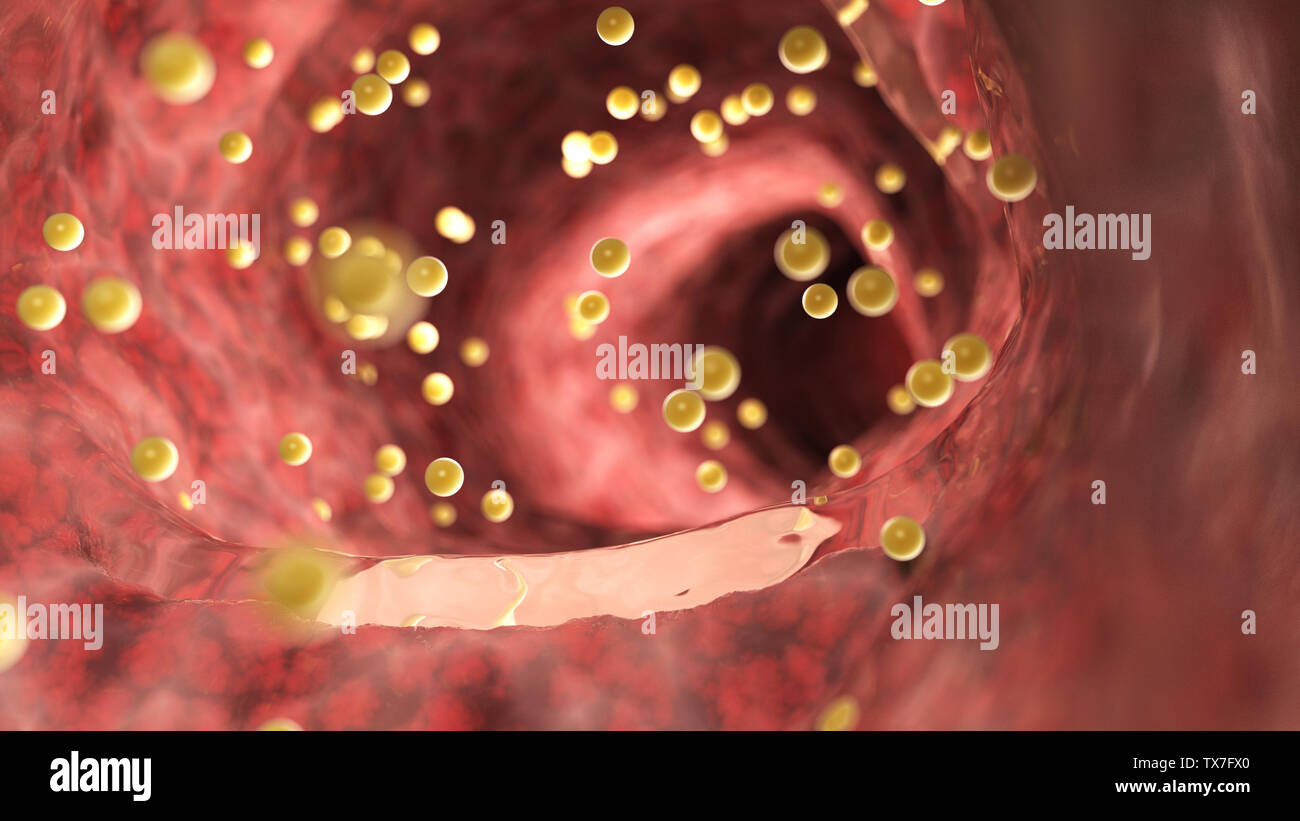 Rendu 3d illustration de gluten médicalement exacts à l'intérieur du colon Banque D'Images