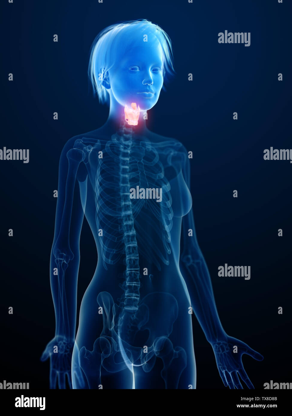 Rendu 3D précis médicalement illustration d'une inflammation du larynx Banque D'Images