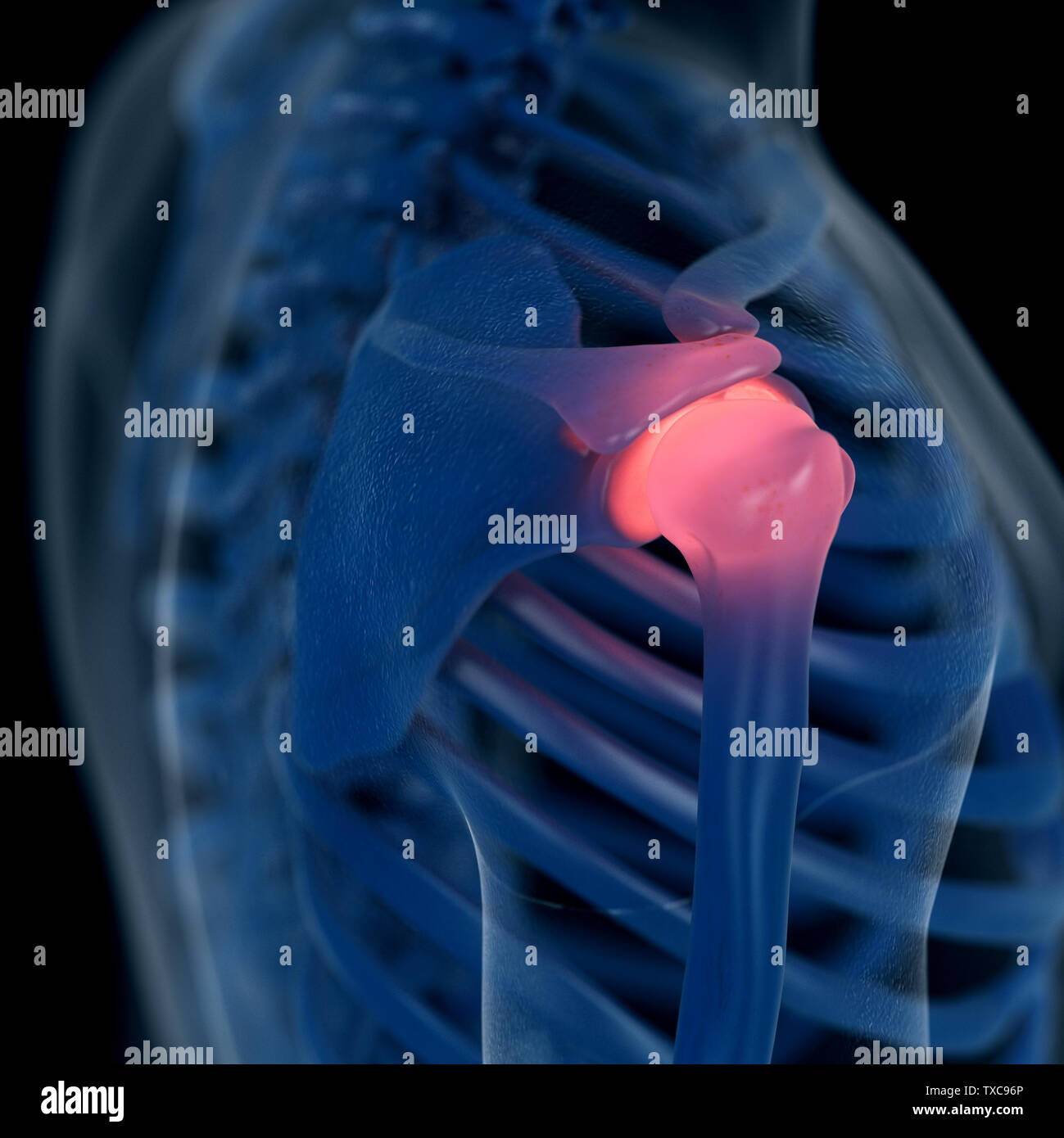 Médicalement en rendu 3d illustration d'un précis de l'épaule douloureuse Banque D'Images