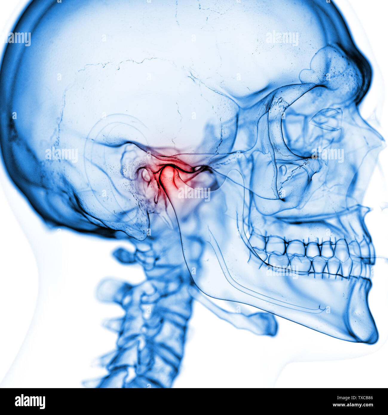 Médicalement en rendu 3d illustration précise de l'articulation temporo-mandibulaire Banque D'Images