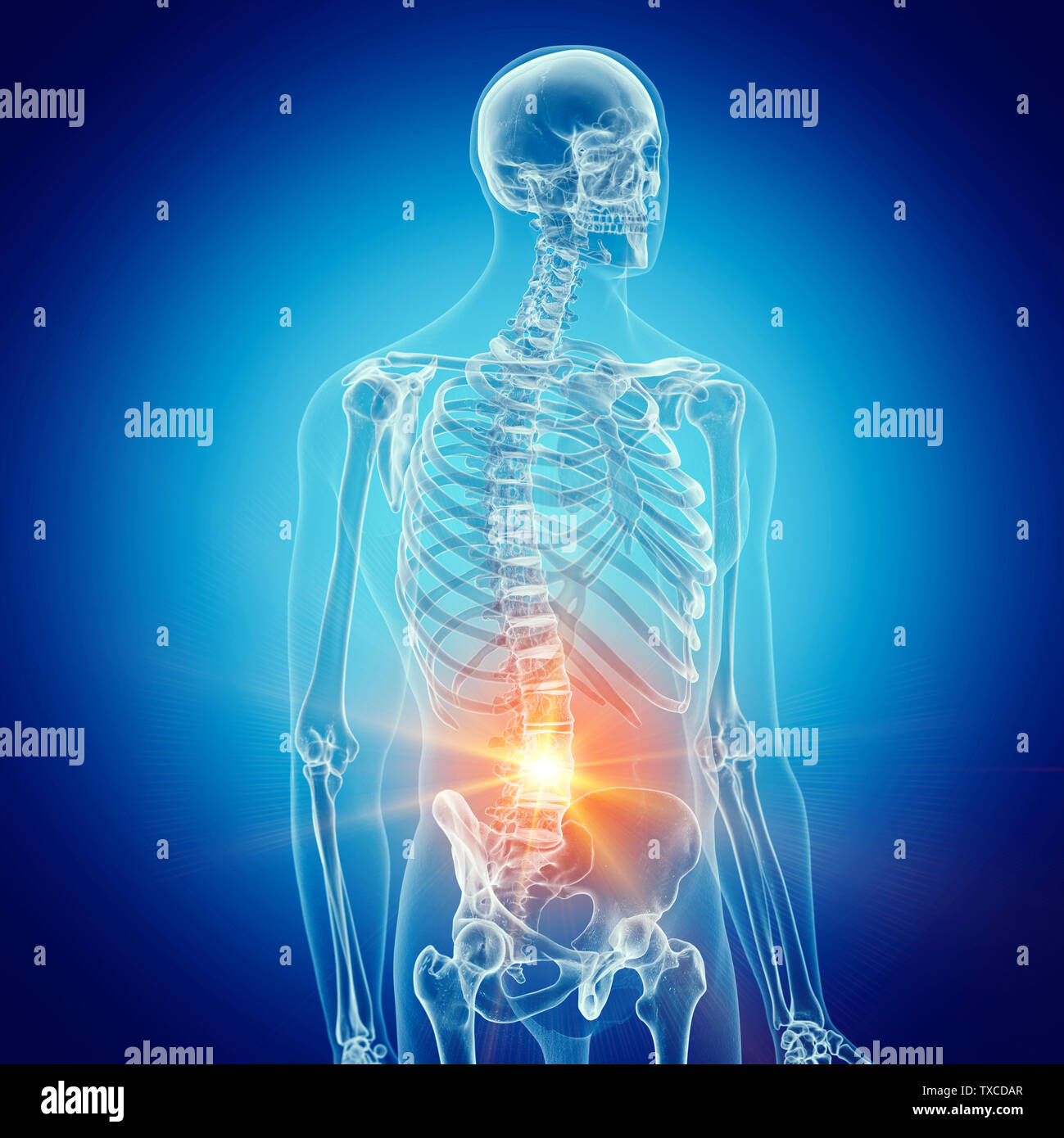 Médicalement en rendu 3d illustration d'un précis de la colonne lombaire douloureuse Banque D'Images