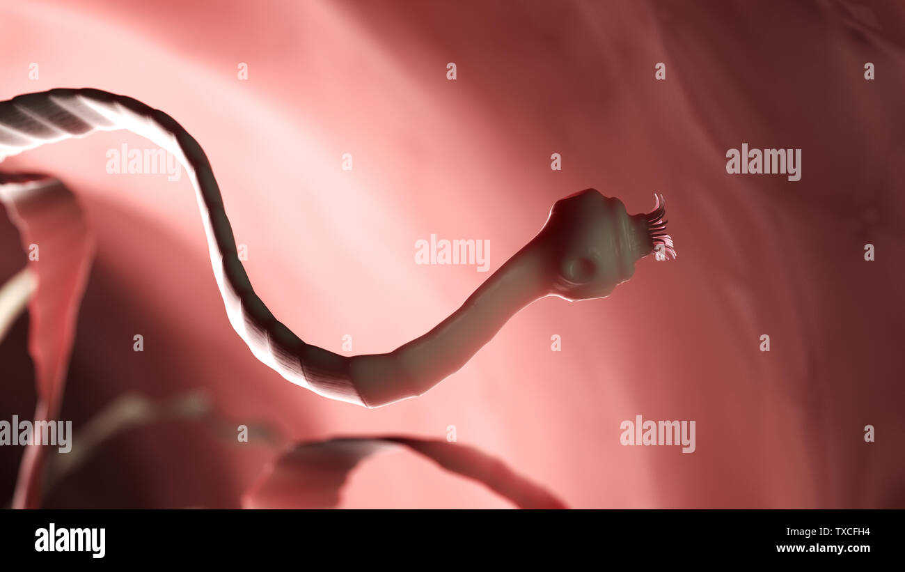 Médicalement en rendu 3d illustration précise d'un ver solitaire Banque D'Images