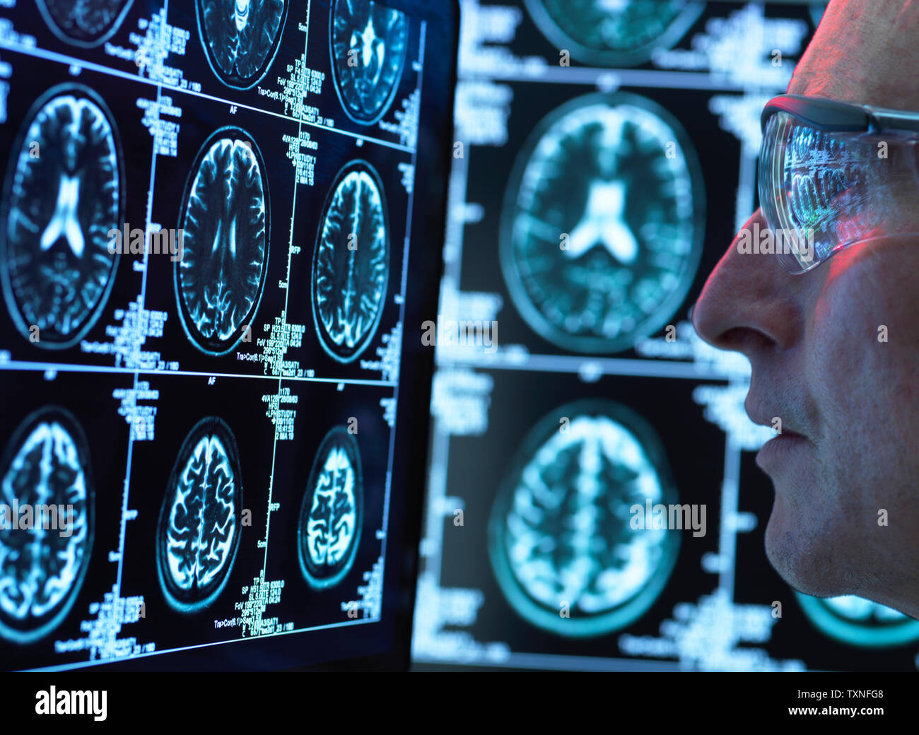 Médecin du cerveau pour visualisation de la maladie ou de dommages possible en clinique Banque D'Images