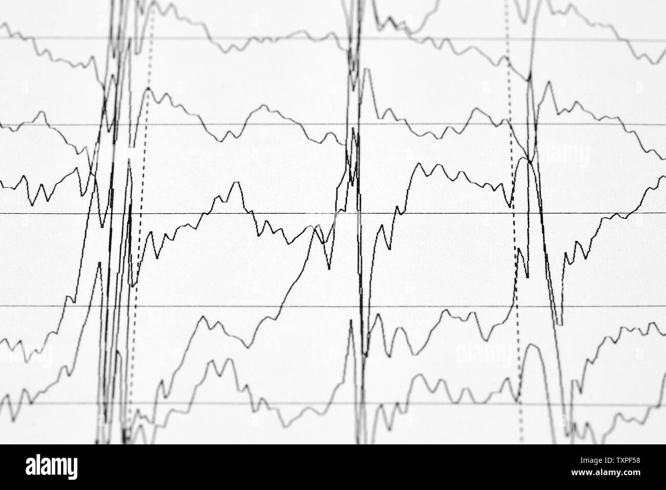 Photo en gros plan d'EKG graphique. Antécédents médicaux. Banque D'Images