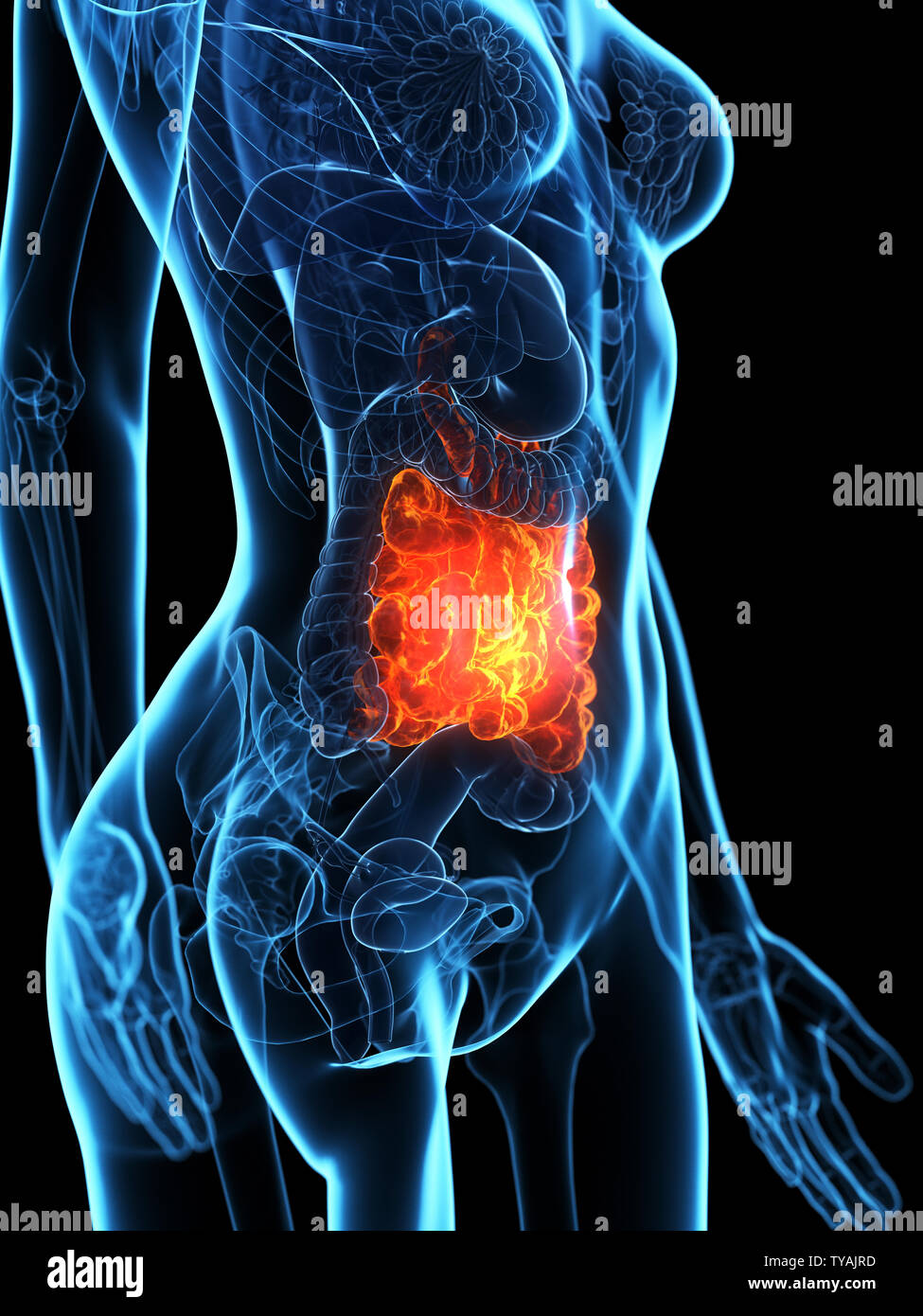 Médicalement en rendu 3d illustration d'un précis de l'intestin grêle maladies Banque D'Images