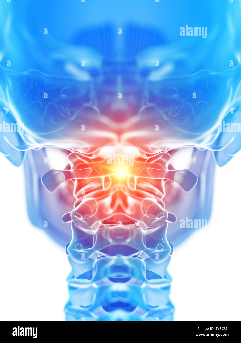 Rendu 3D précis médicalement illustration de l'os atlas montrant la douleur Banque D'Images