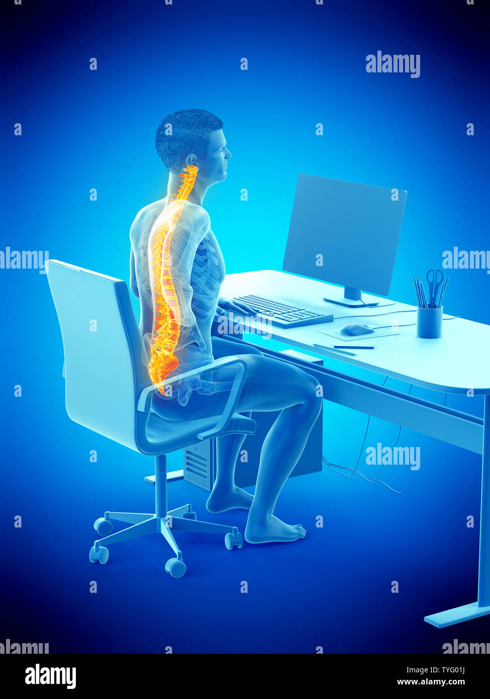 Médicalement en rendu 3d illustration précise d'un des employés de bureau retour douloureux Banque D'Images